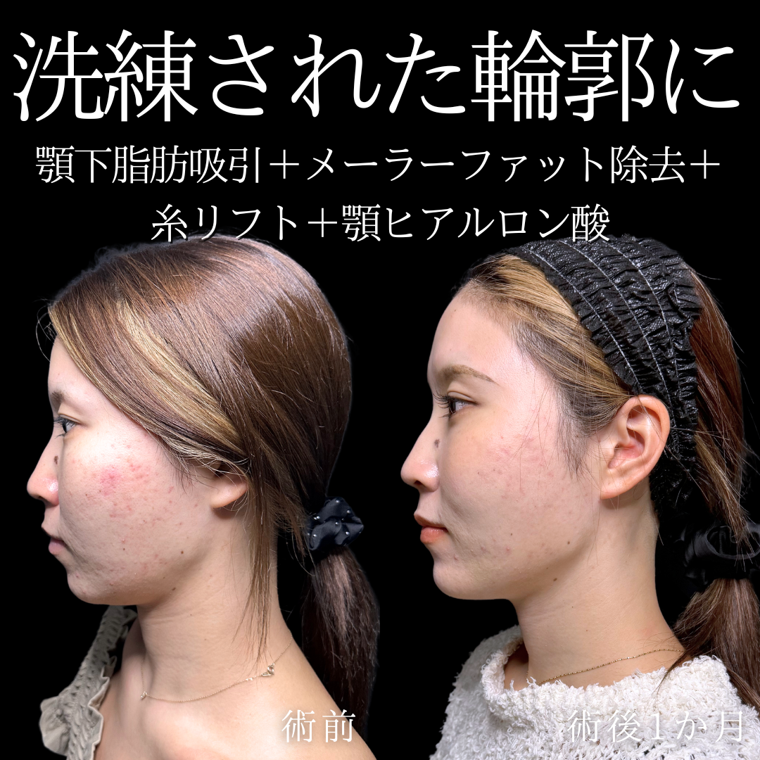 症例イメージ