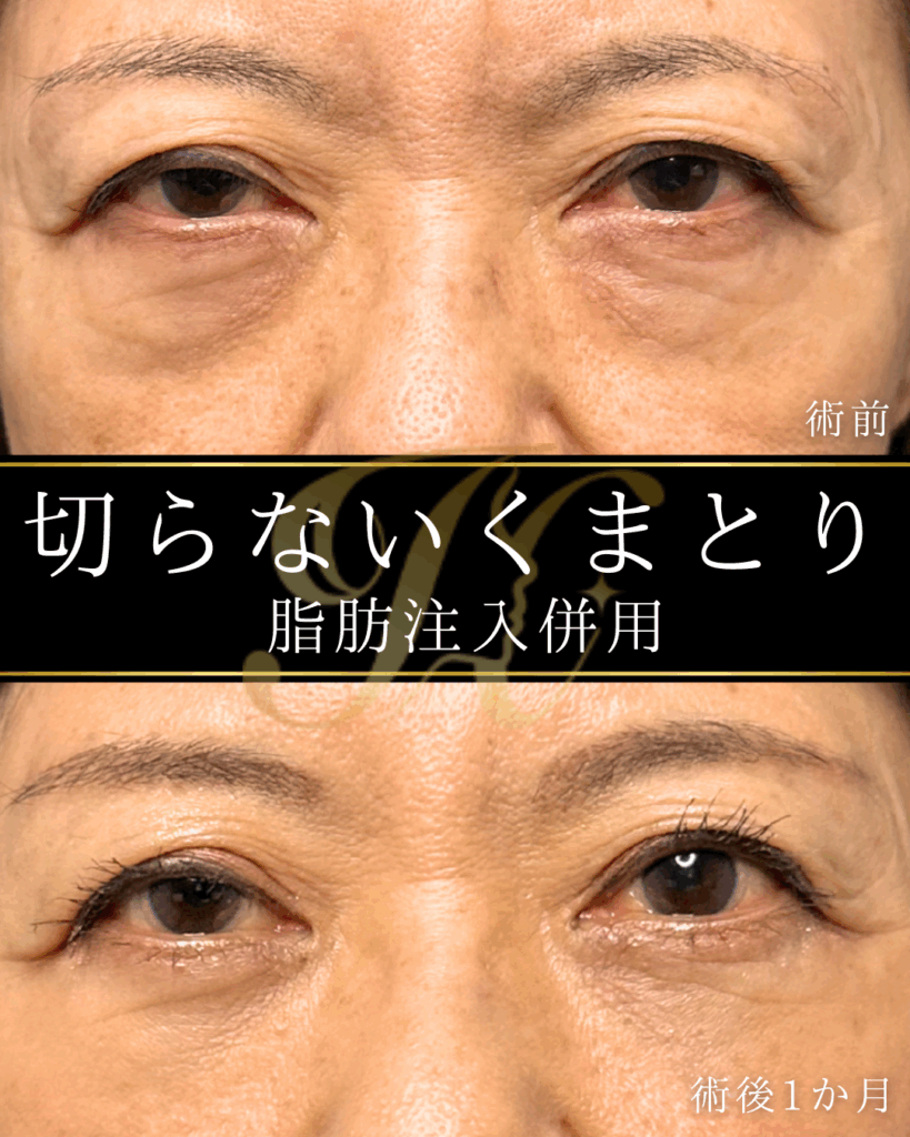 症例イメージ