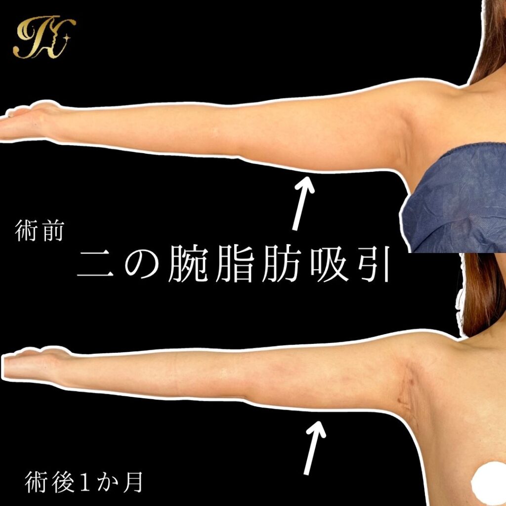 症例イメージ