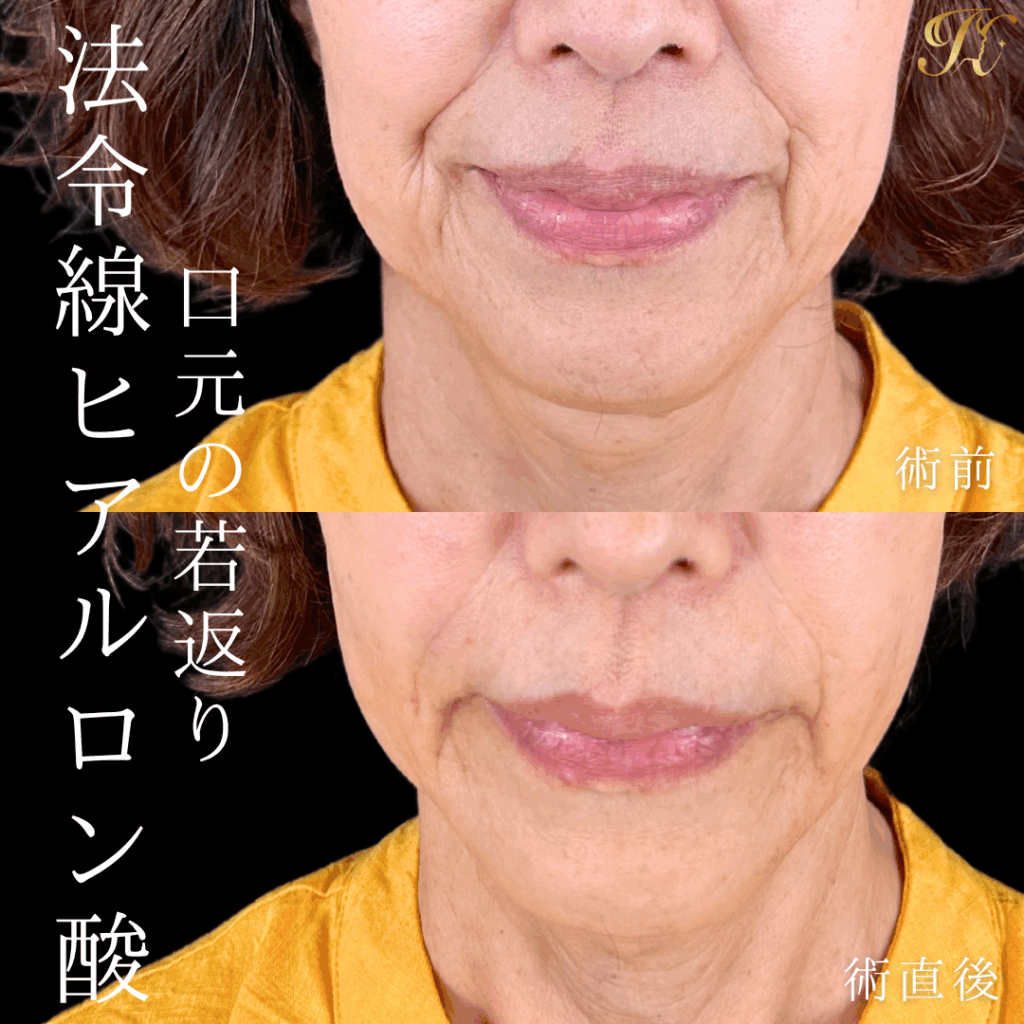 症例イメージ