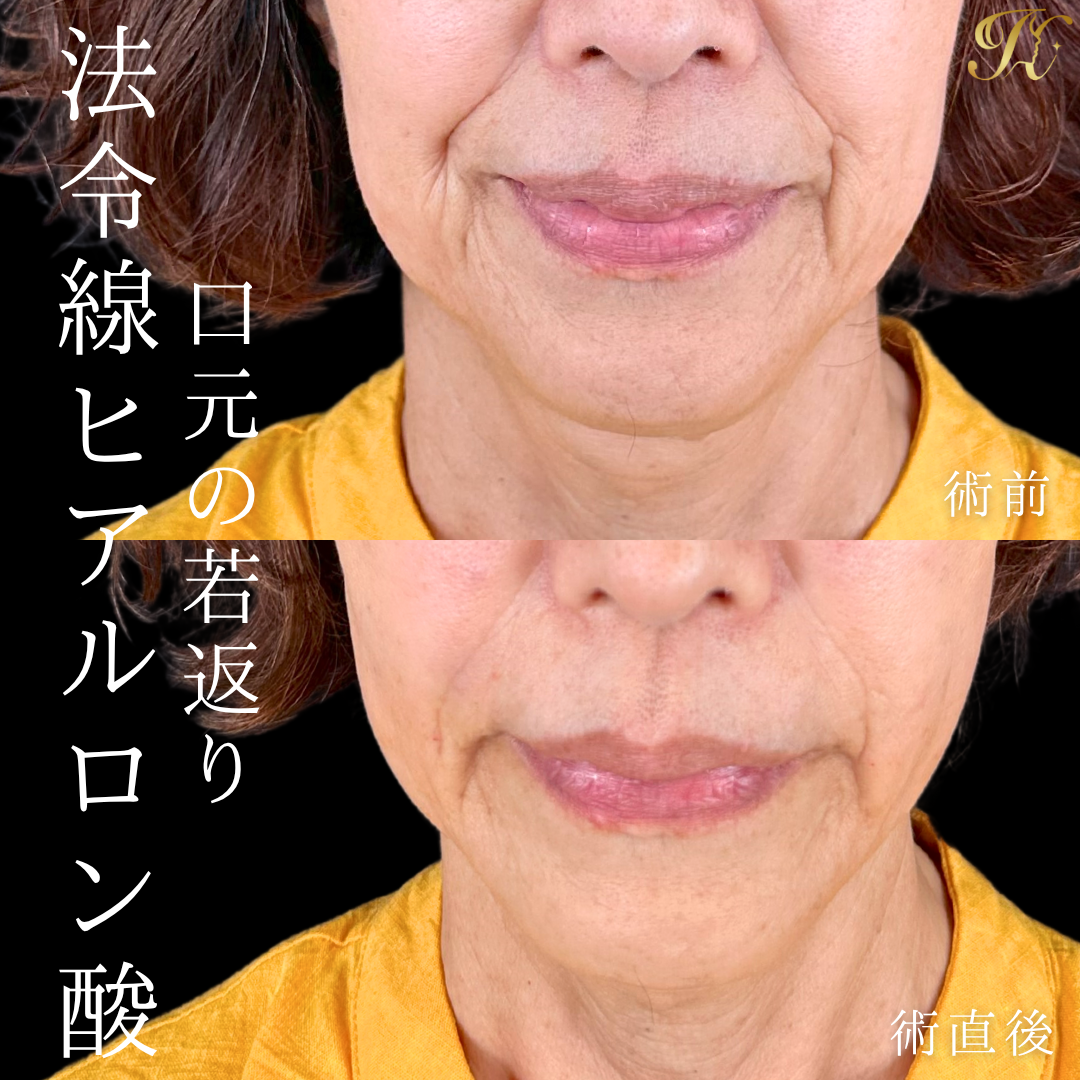 症例イメージ