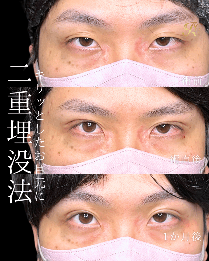 症例イメージ