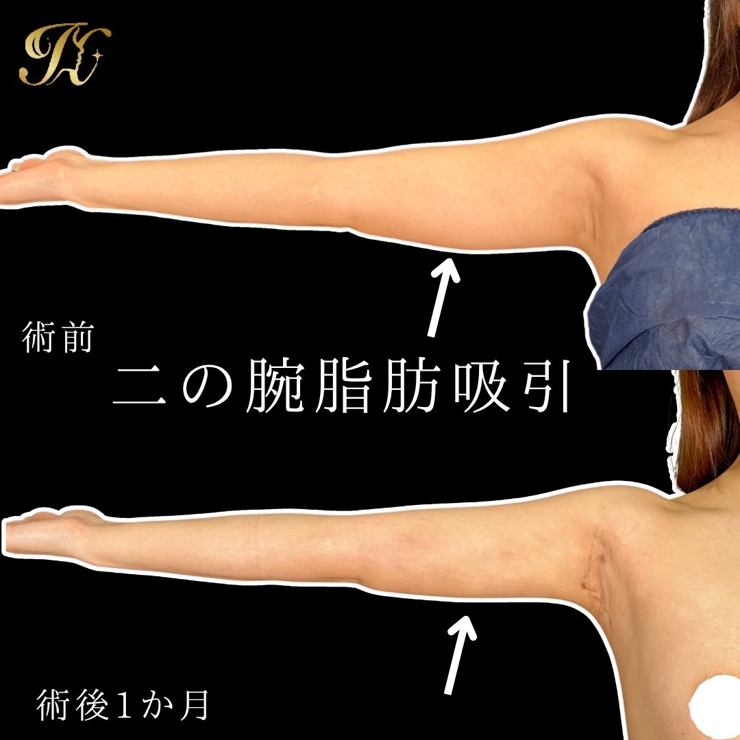 症例イメージ
