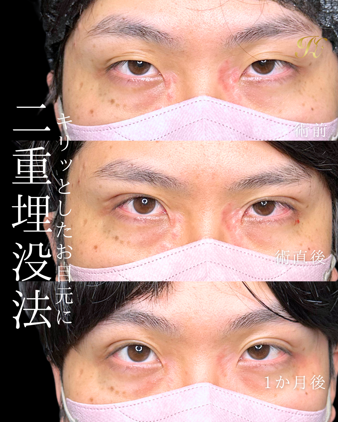 症例イメージ