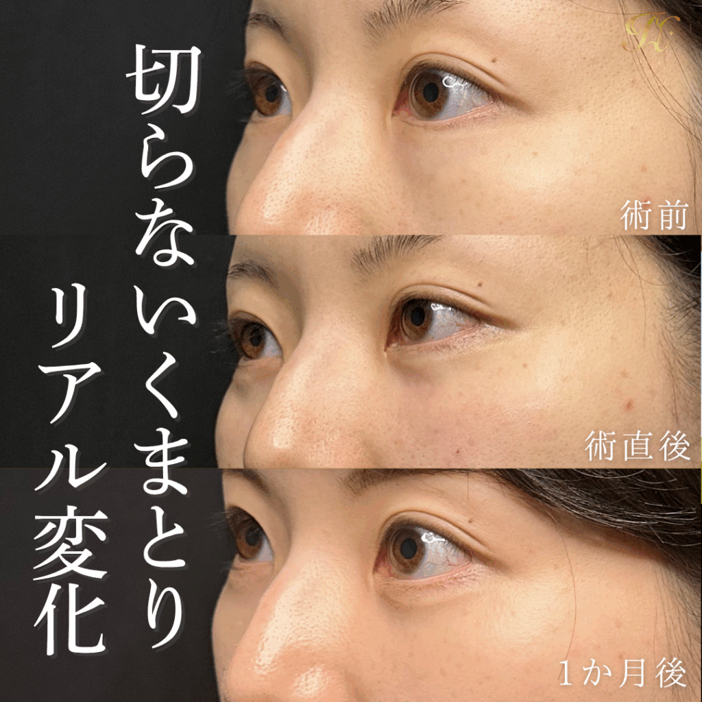 症例イメージ