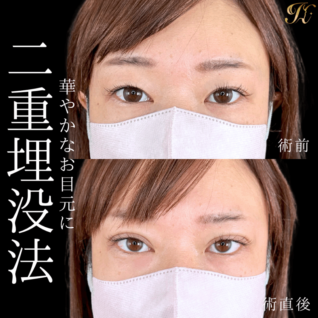 症例イメージ