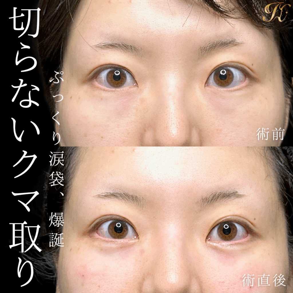 症例イメージ