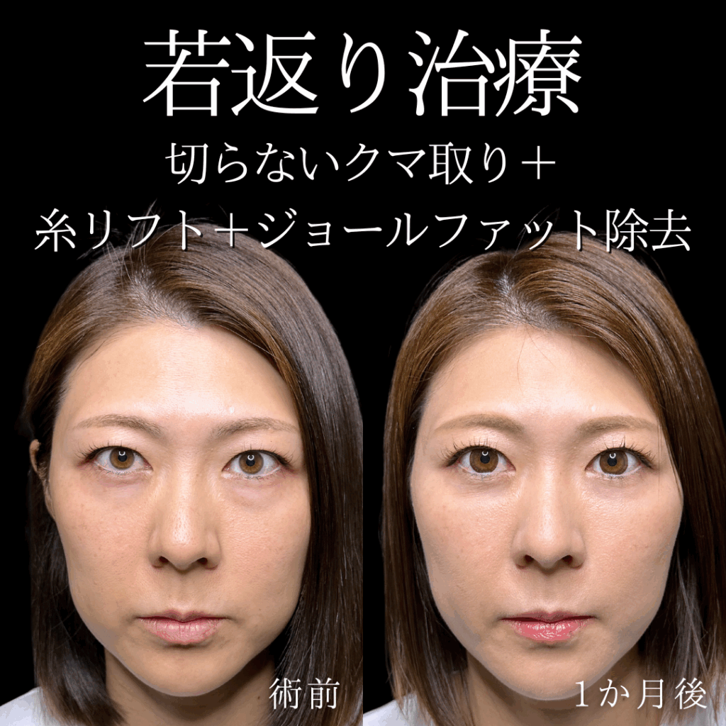 症例イメージ