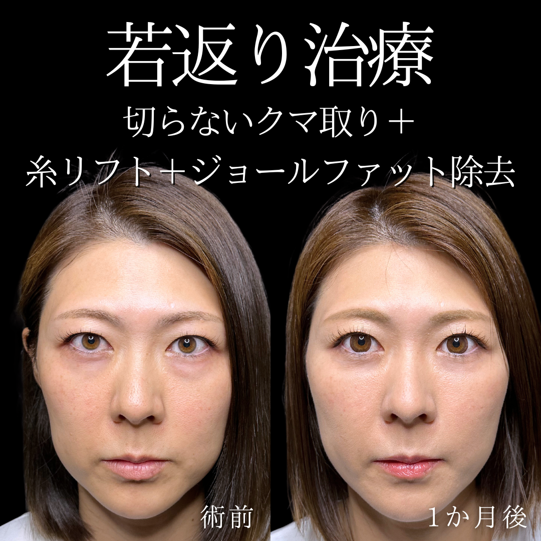 症例イメージ