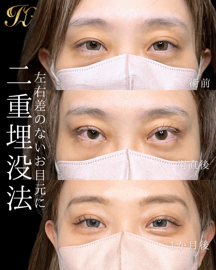 症例イメージ