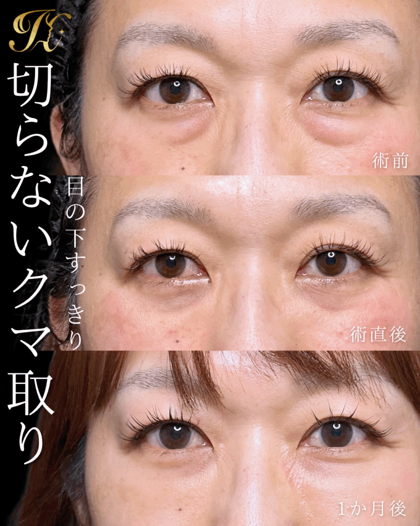 症例イメージ