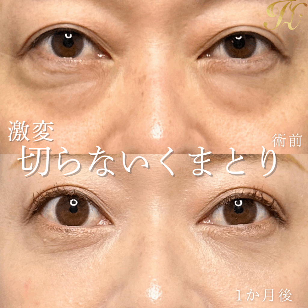 症例イメージ