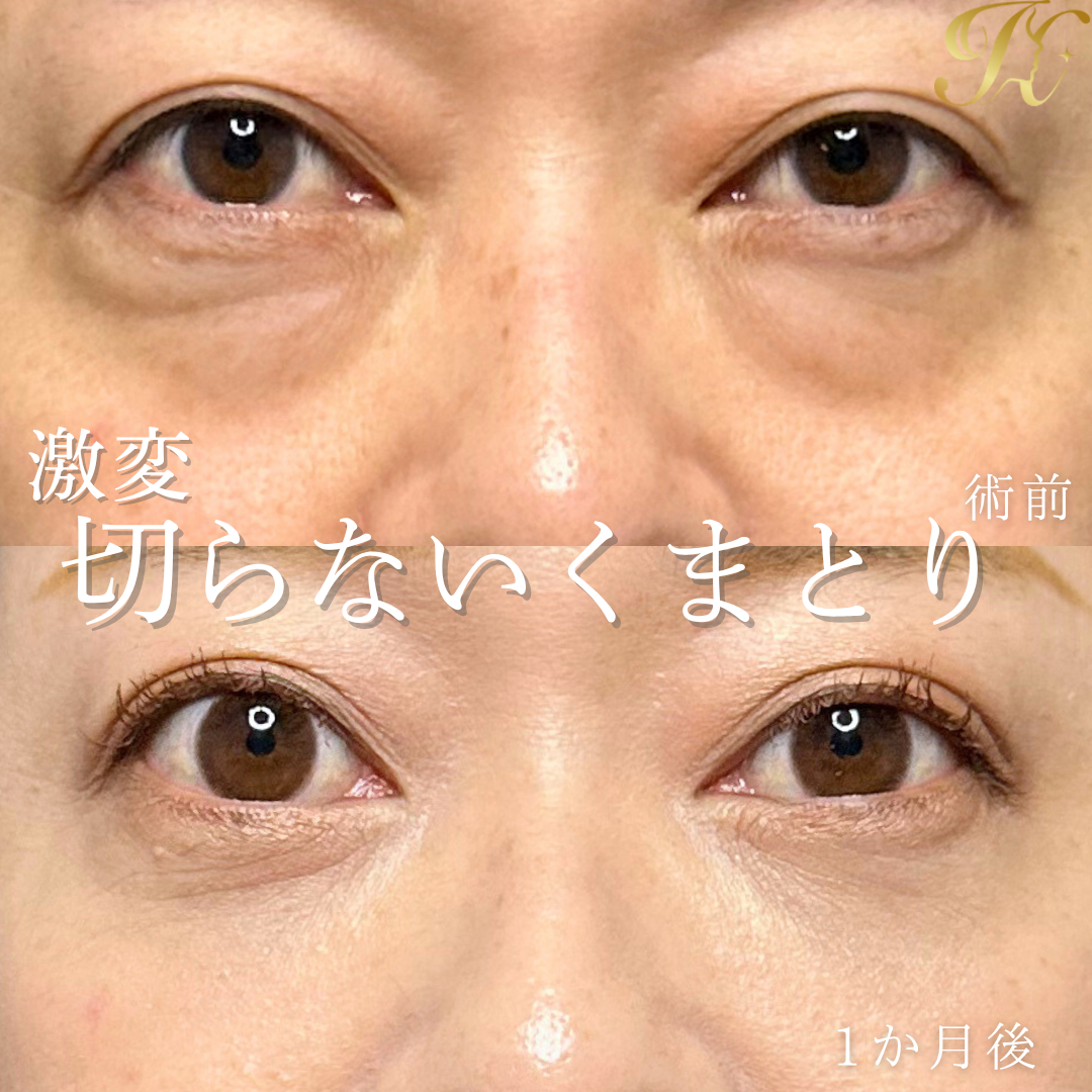 症例イメージ