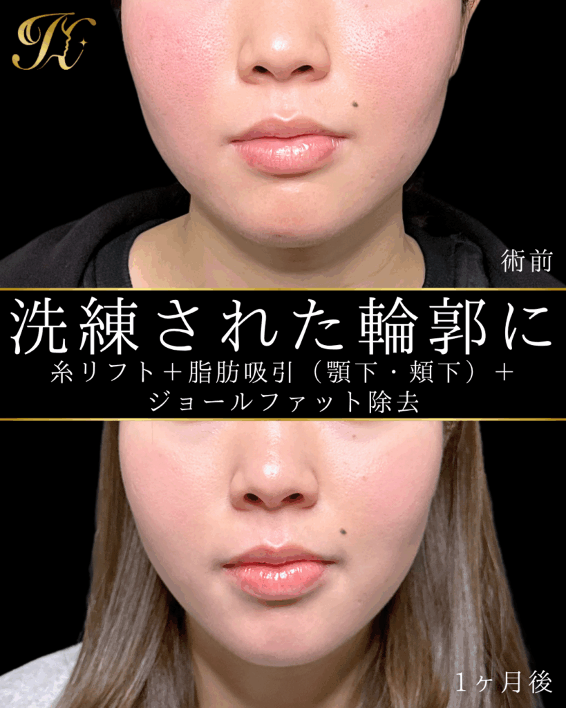 症例イメージ