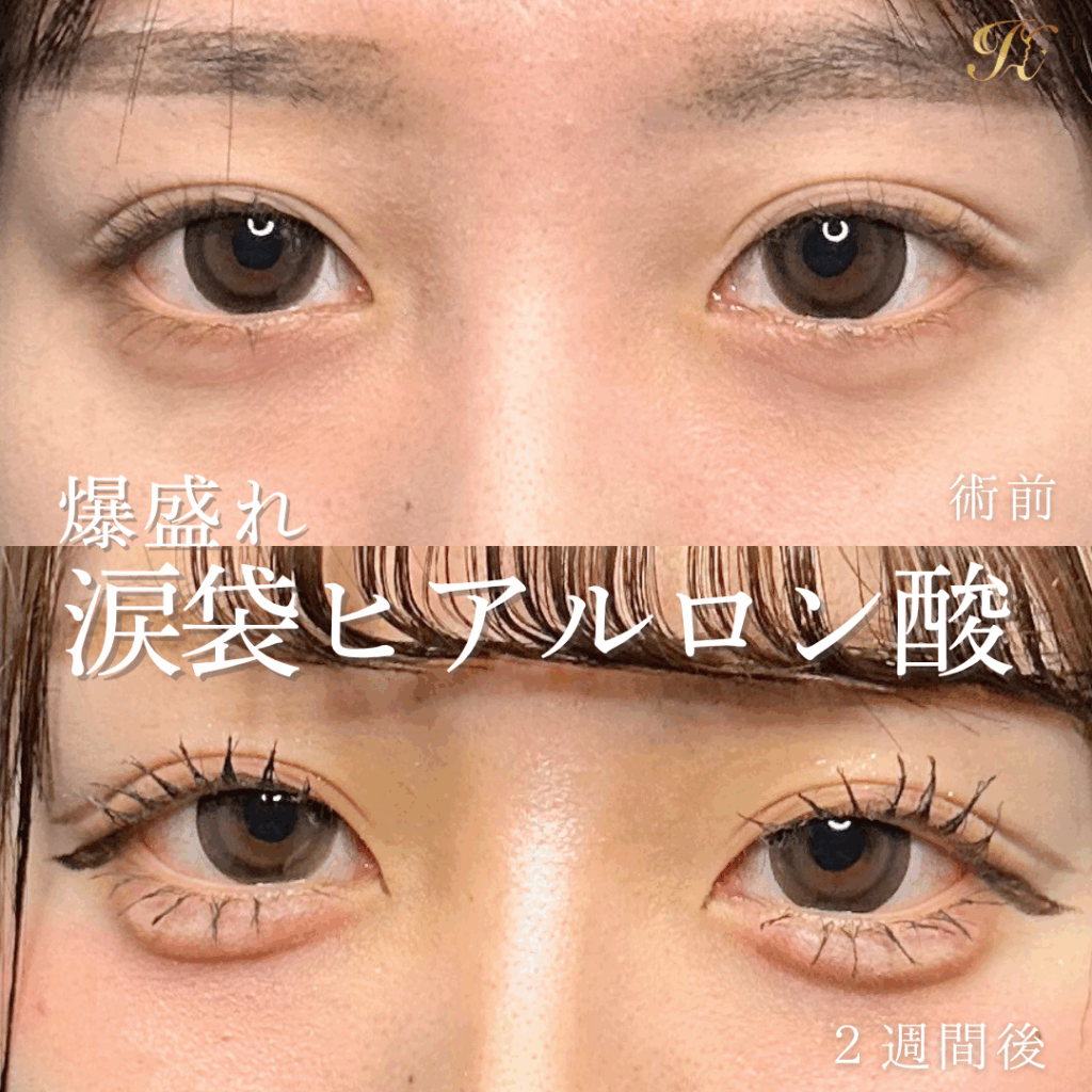 症例イメージ