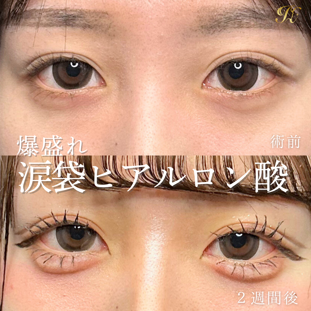 症例イメージ