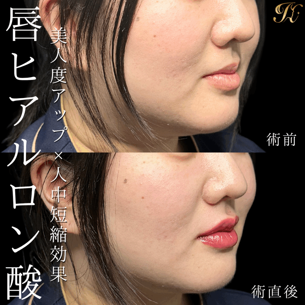 症例イメージ