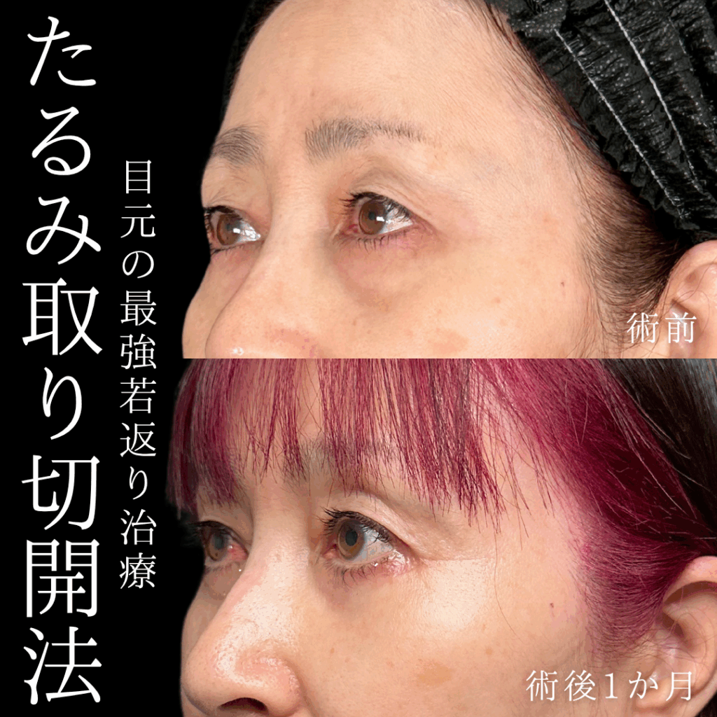 症例イメージ
