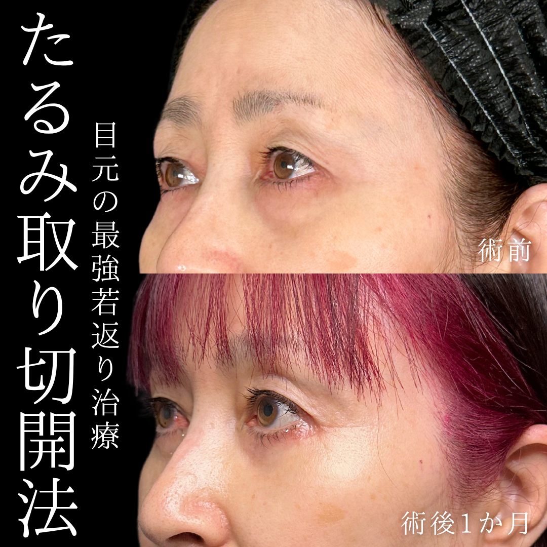 症例イメージ
