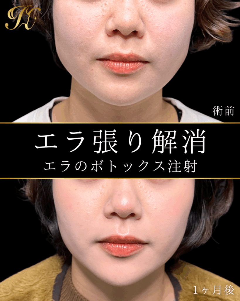 症例イメージ