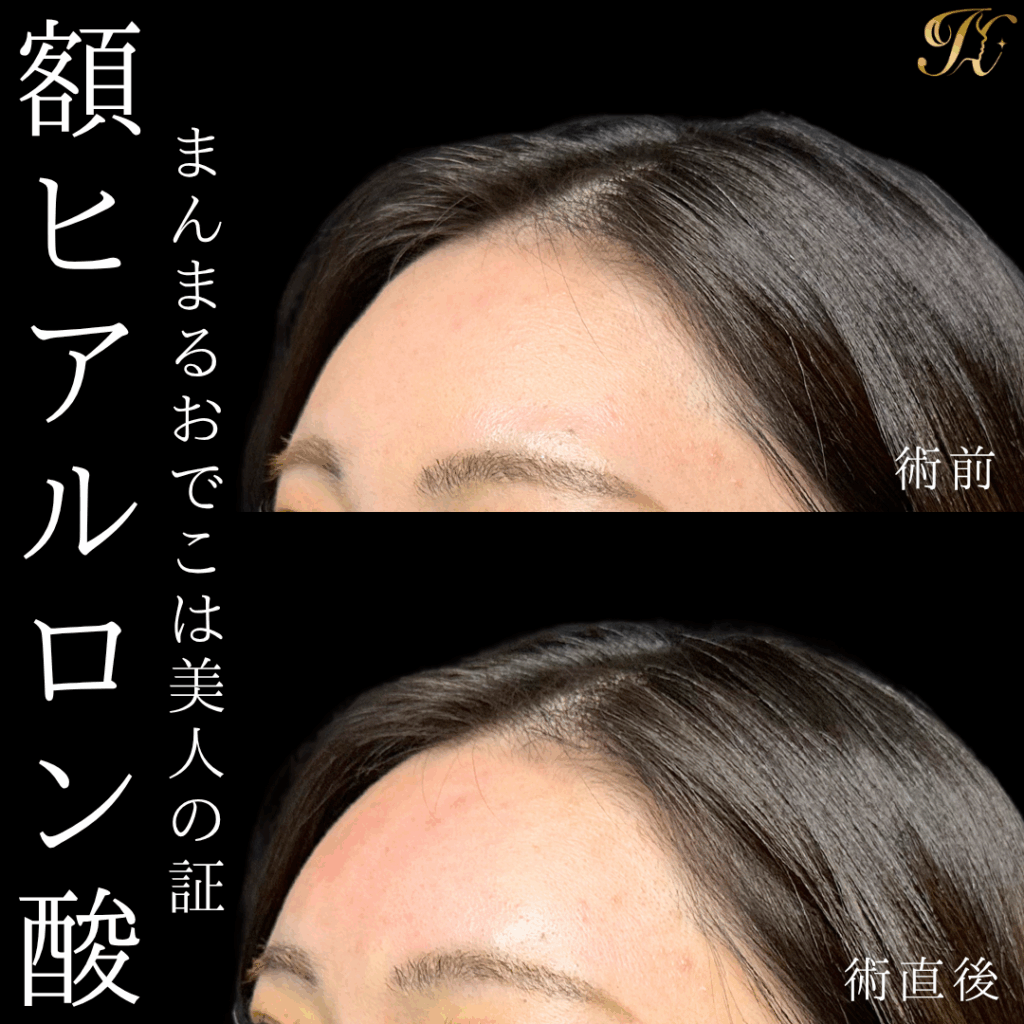 症例イメージ