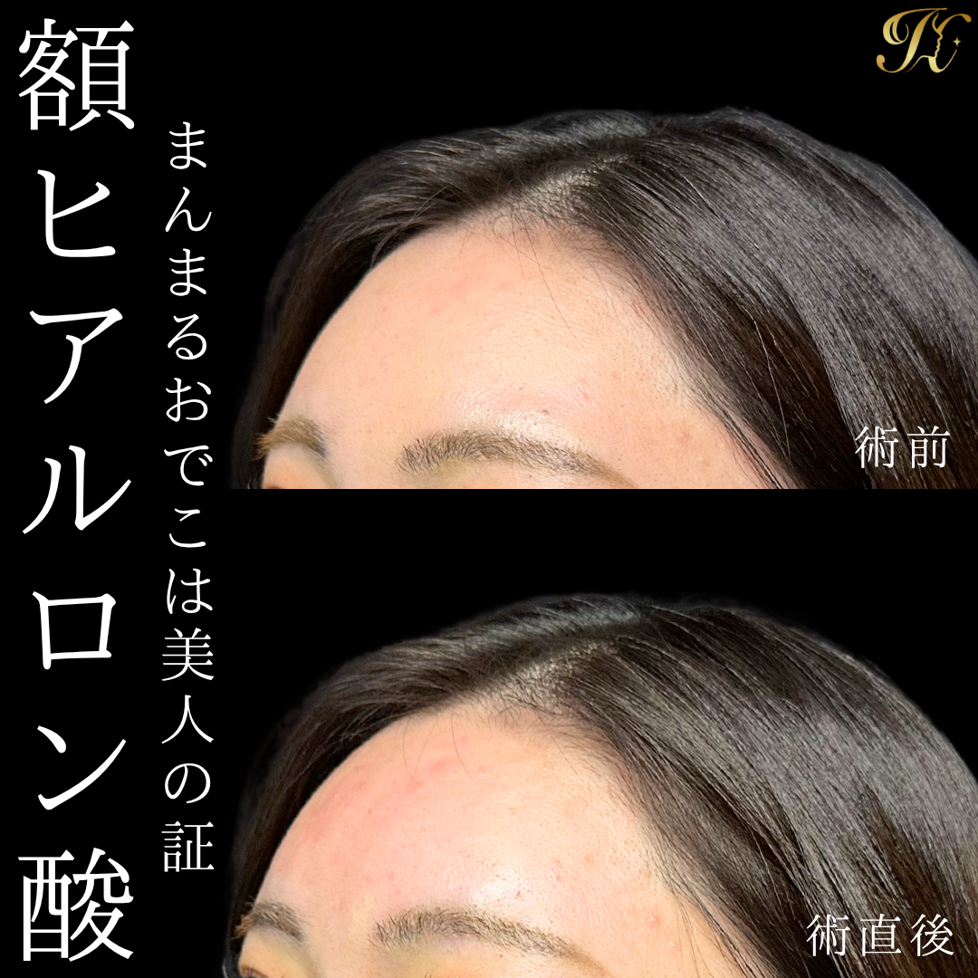 症例イメージ
