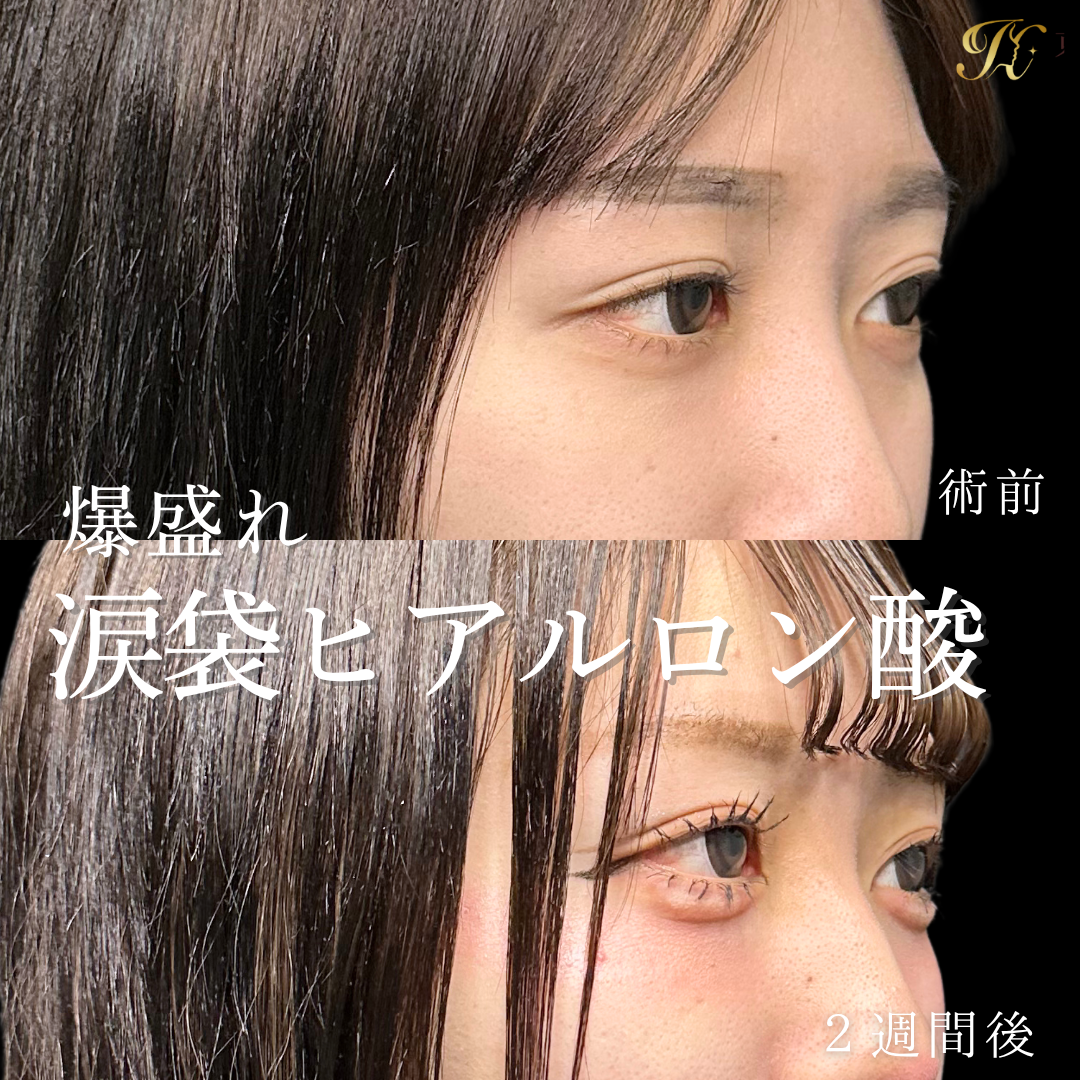 症例イメージ