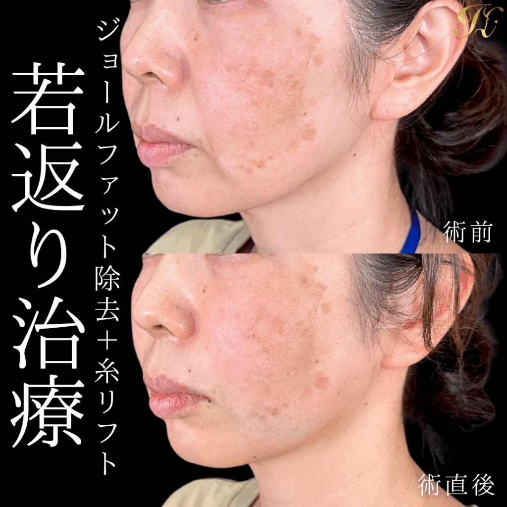症例イメージ