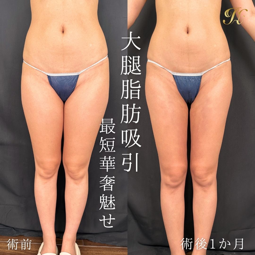 症例イメージ