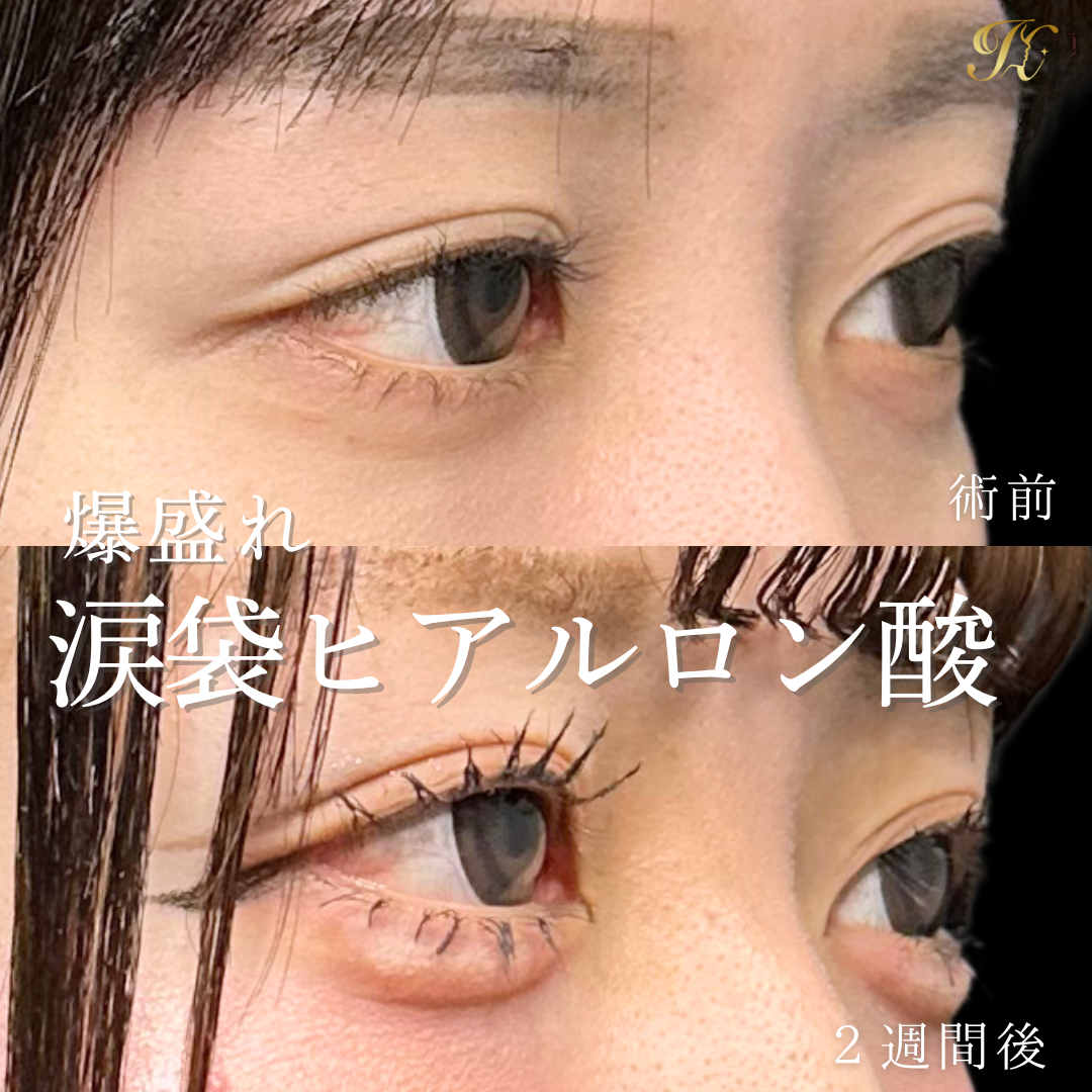 症例イメージ