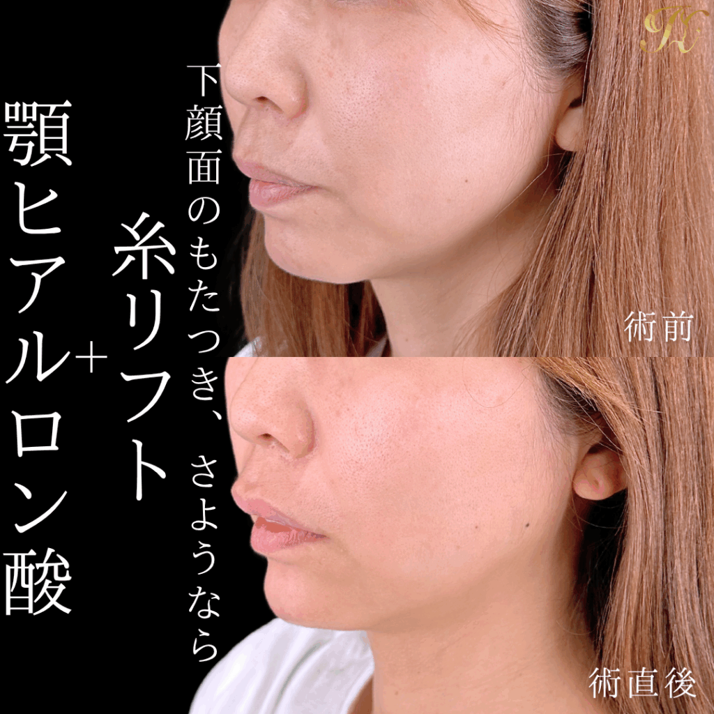 症例イメージ