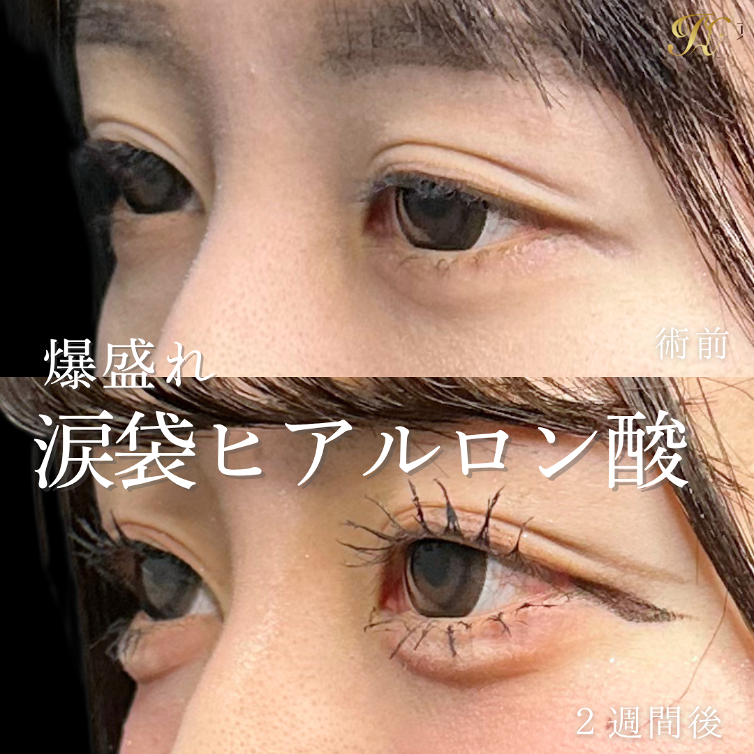 症例イメージ