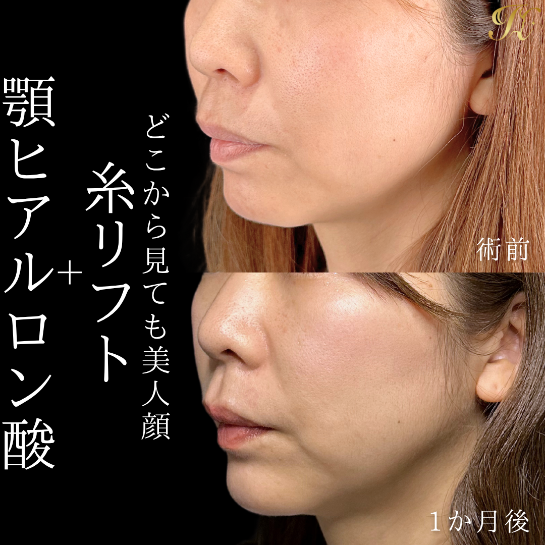 症例イメージ