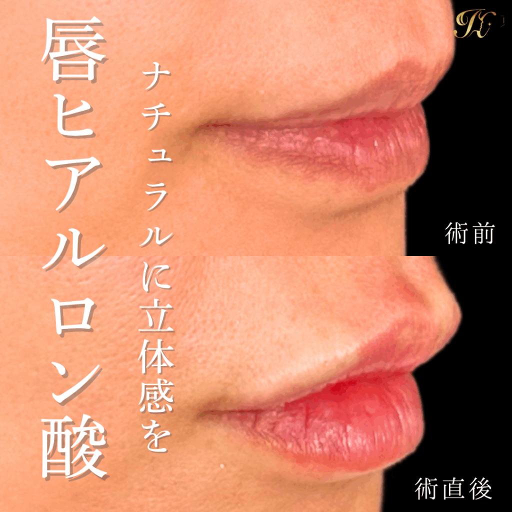 症例イメージ