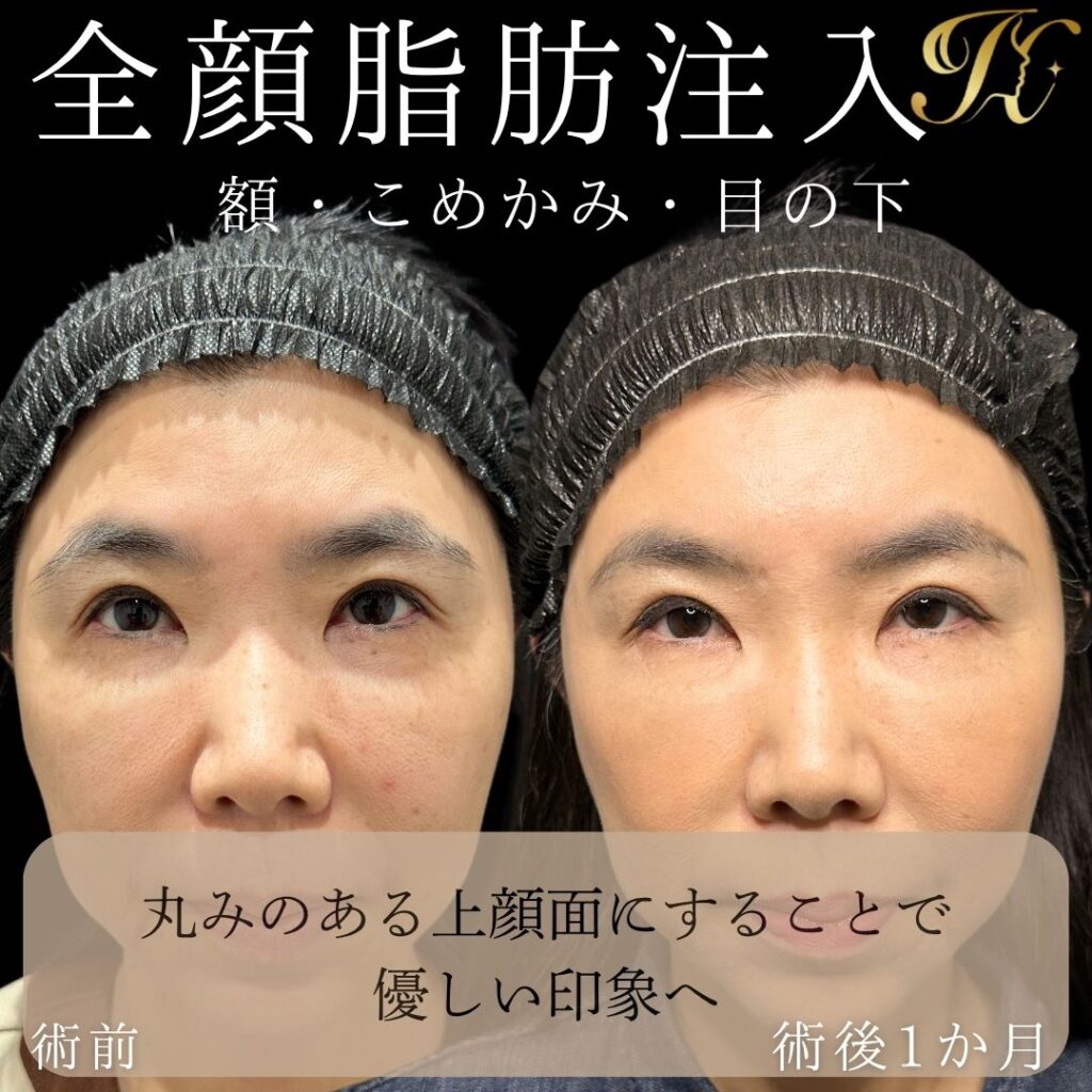 症例イメージ
