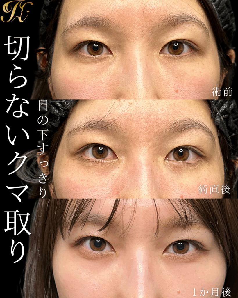 症例イメージ