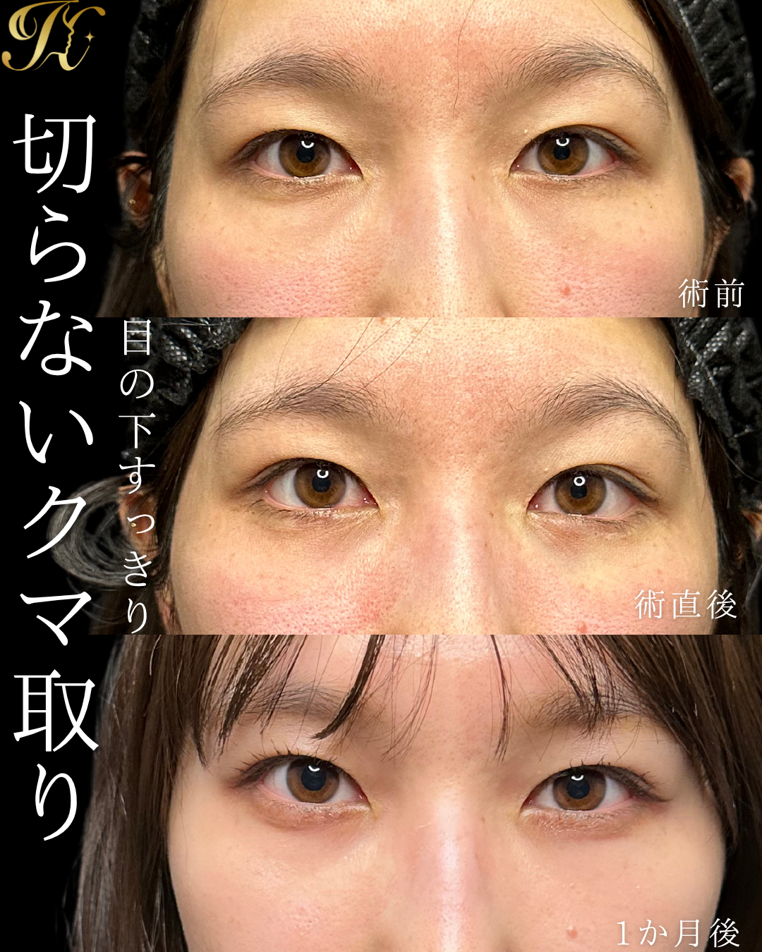 症例イメージ