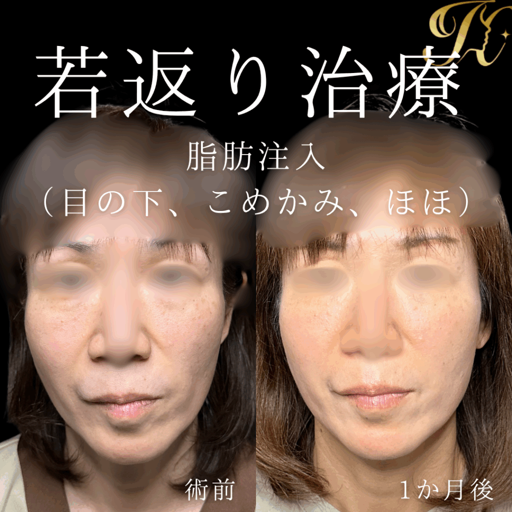 症例イメージ