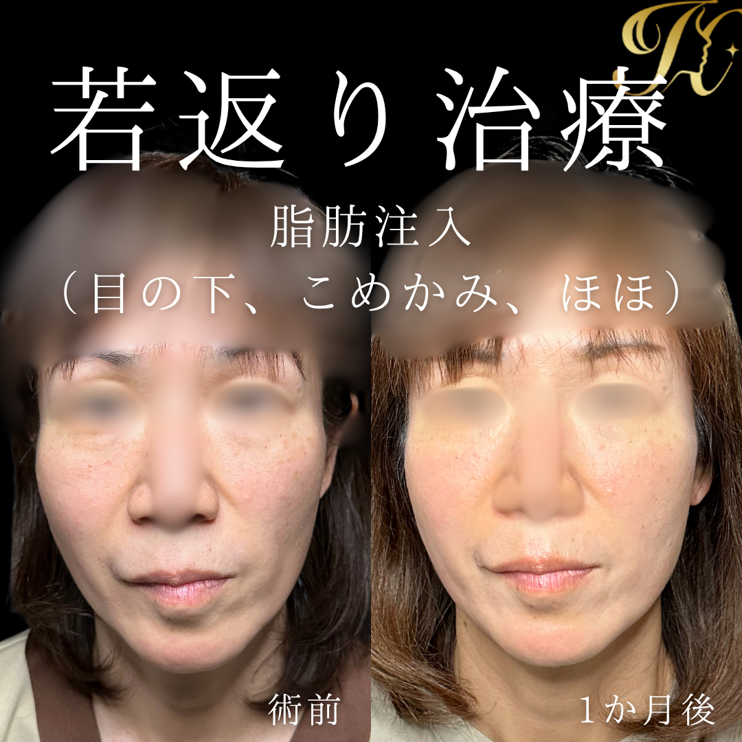 症例イメージ