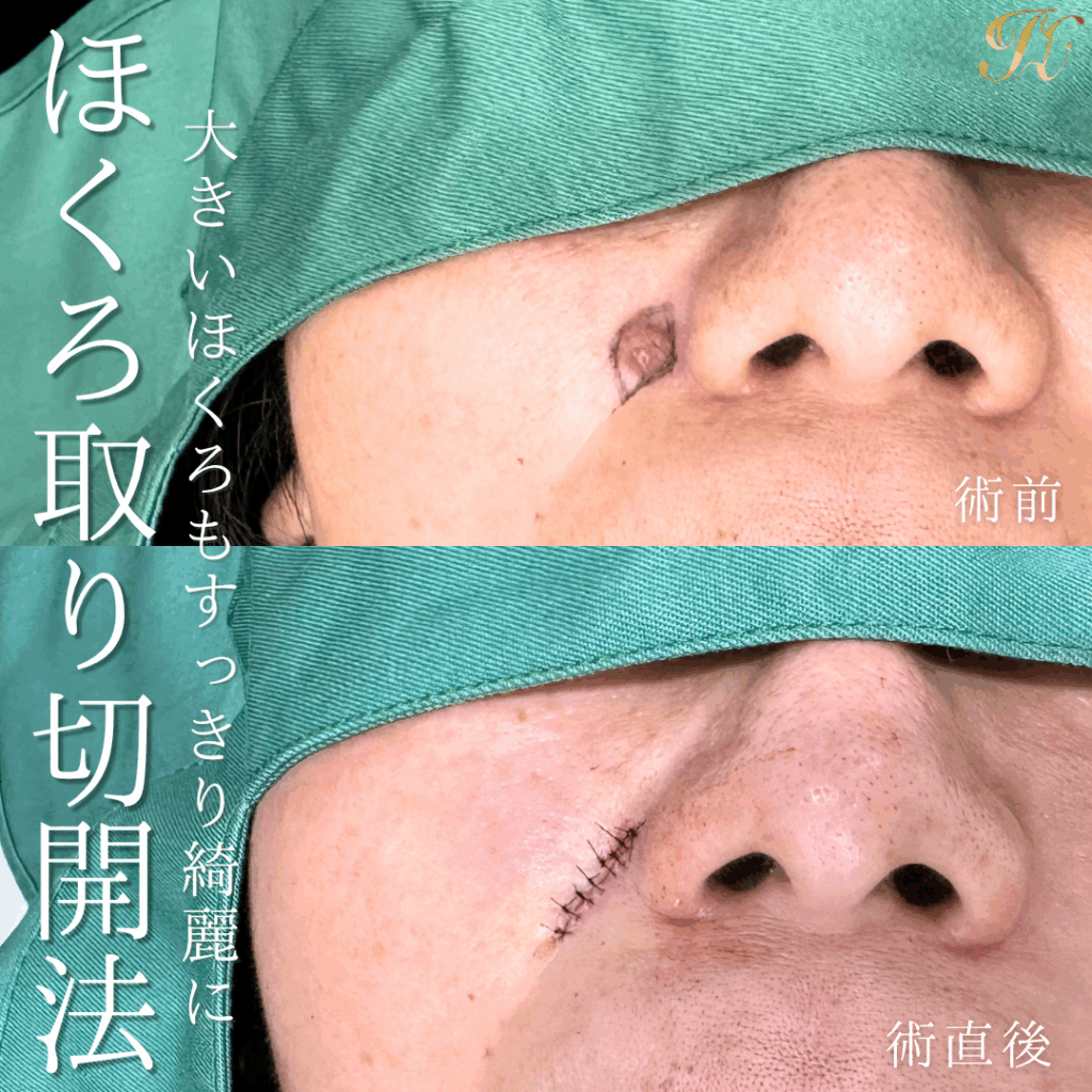 症例イメージ