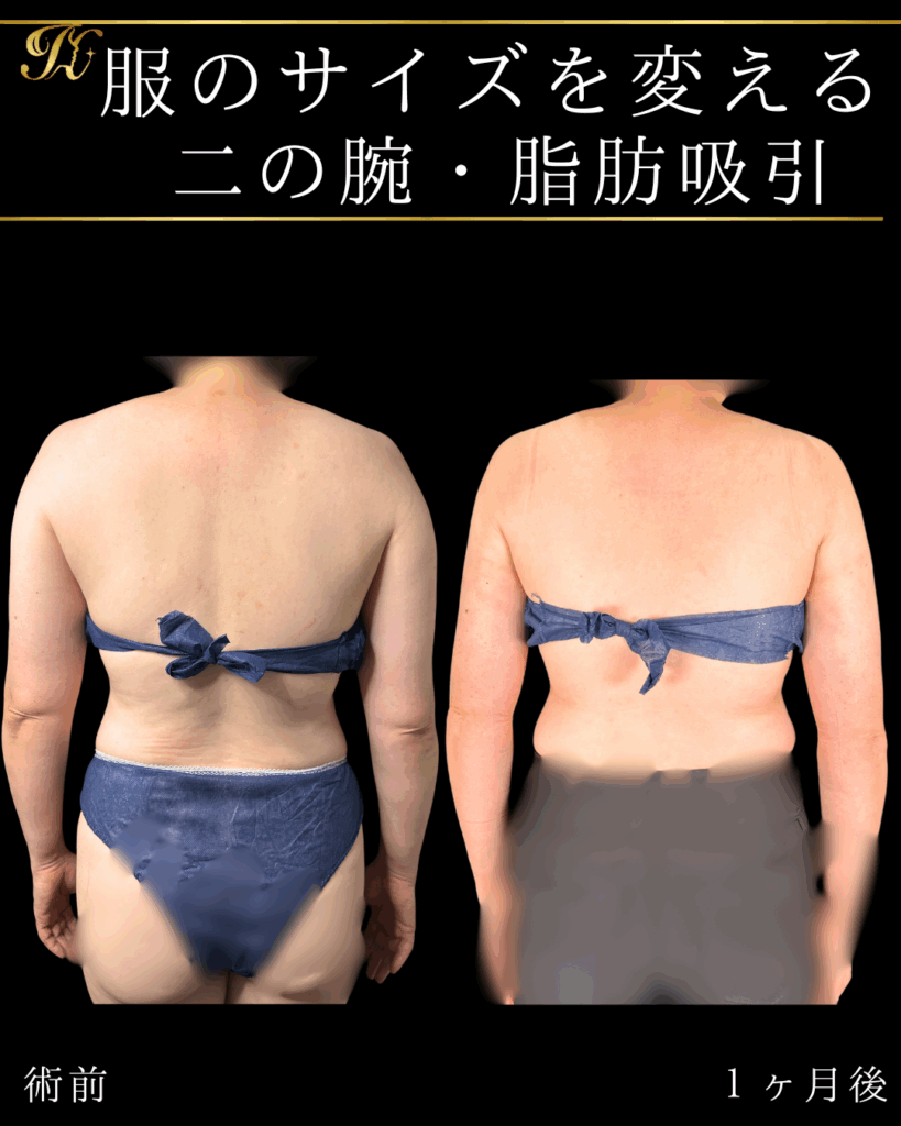 症例イメージ