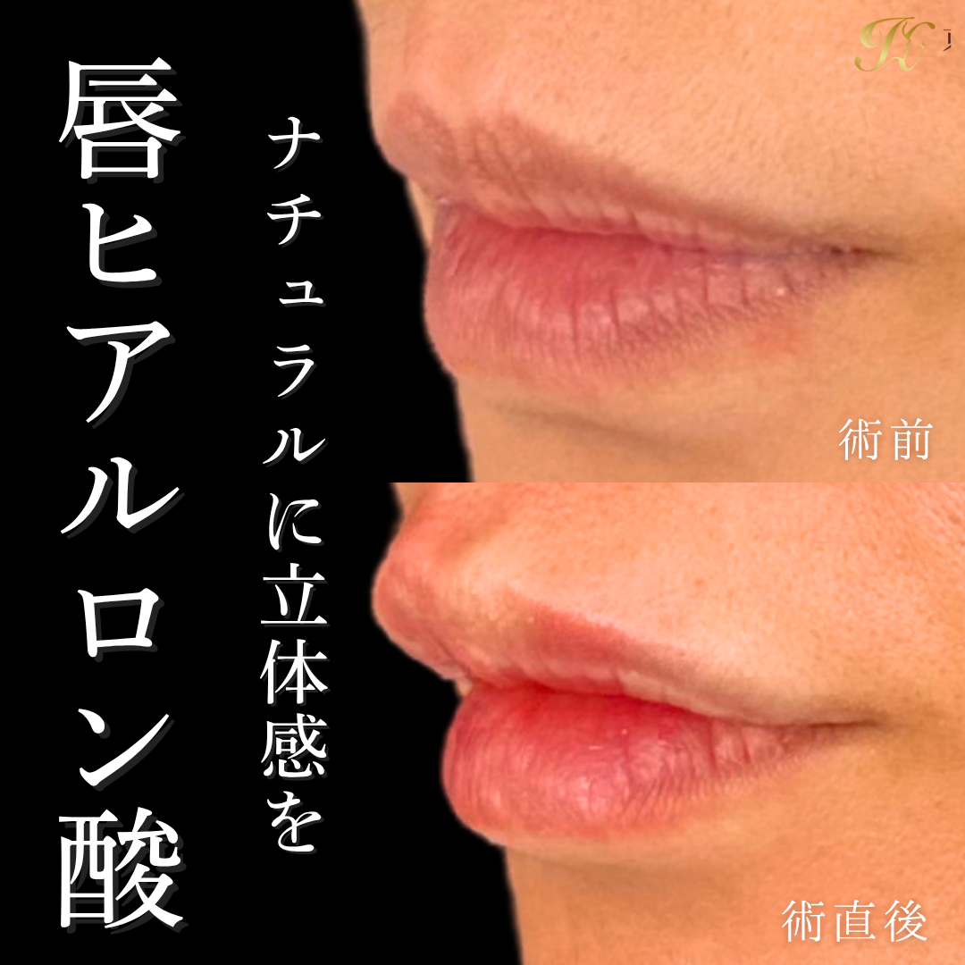 症例イメージ