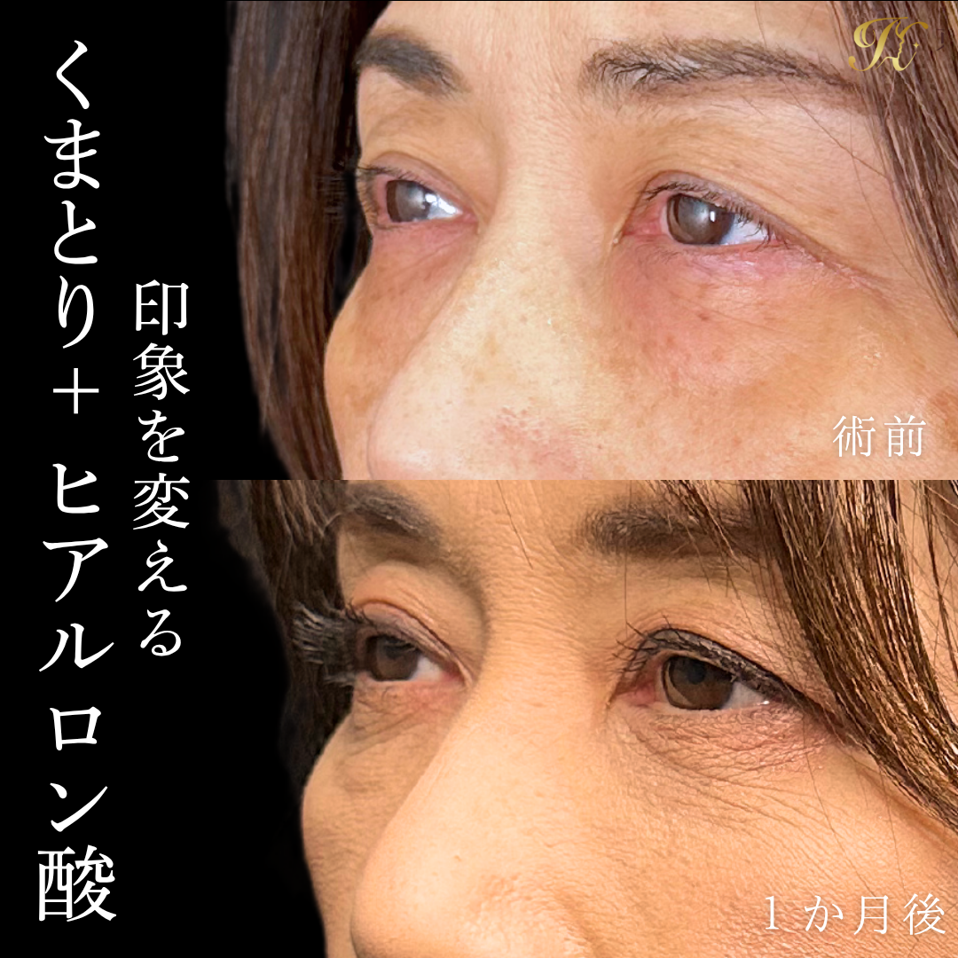 症例イメージ