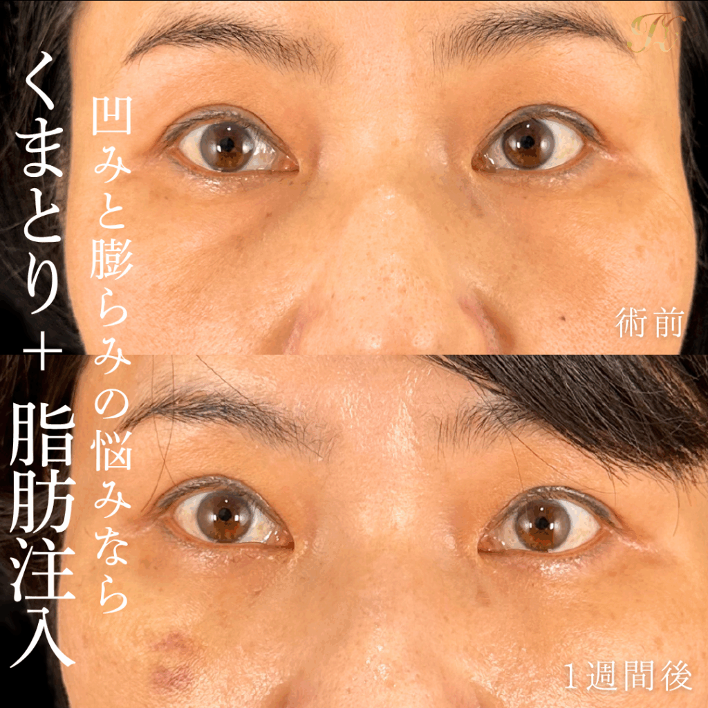 症例イメージ