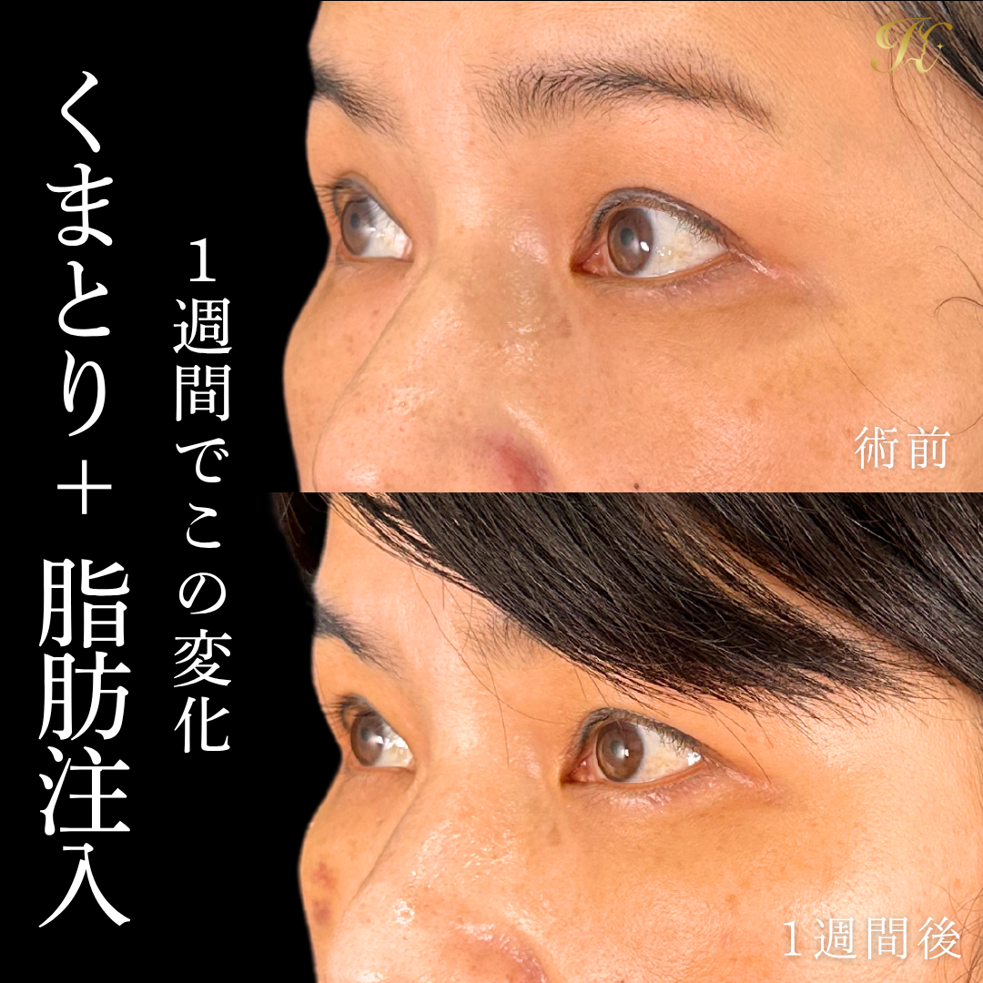 症例イメージ