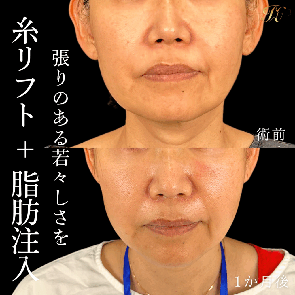 症例イメージ