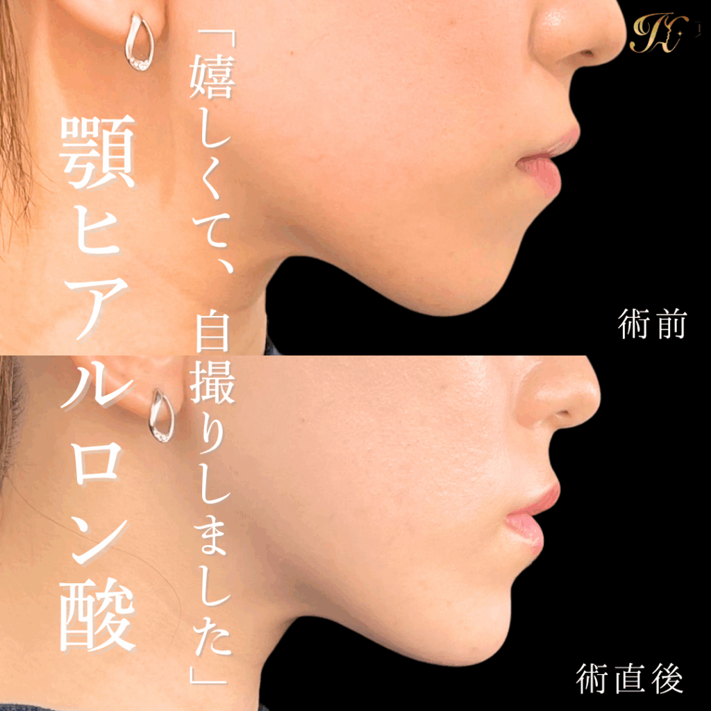 症例イメージ