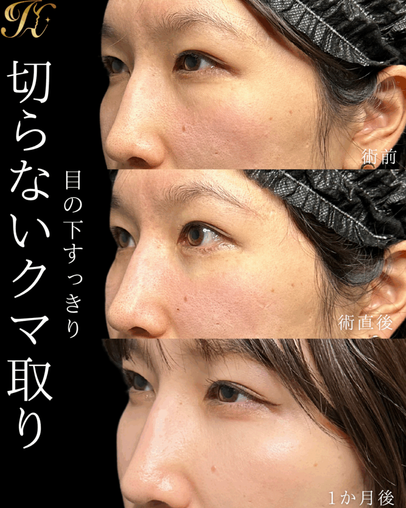 症例イメージ