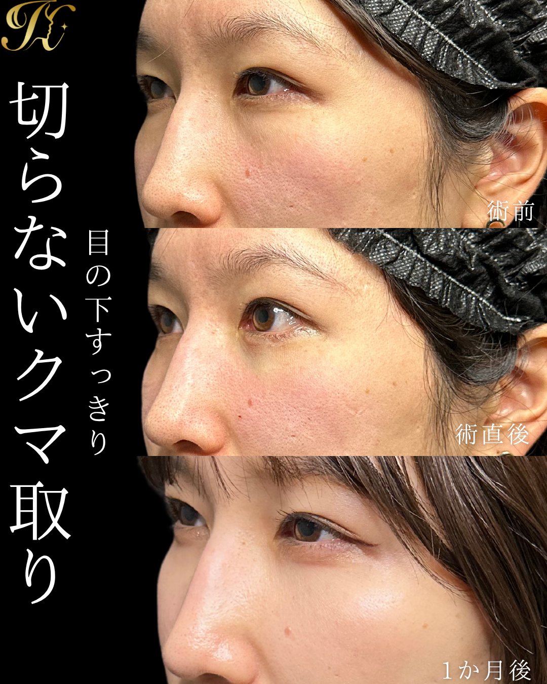 症例イメージ