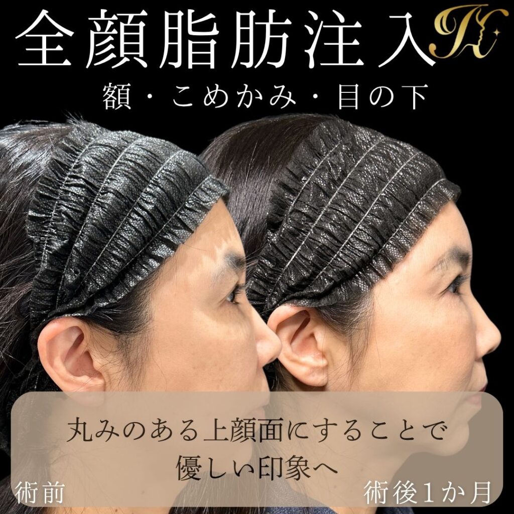 症例イメージ